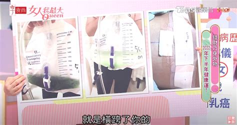 乳暈生毛|乳頭毛